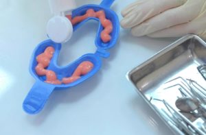 Fluoride treatment prepared in a blue mouthguard on a dentists tray ready to be used on a patient