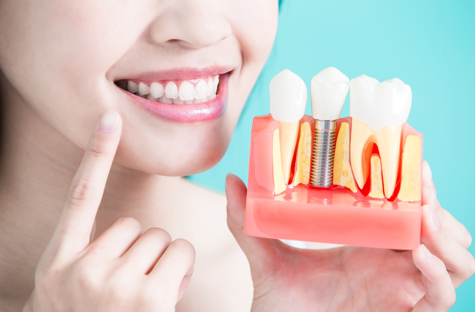 10 Signs You Need Dental Implants│Calgary│West 85th Dental