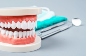 A model of teeth sitting on a grey background next to some dental tools