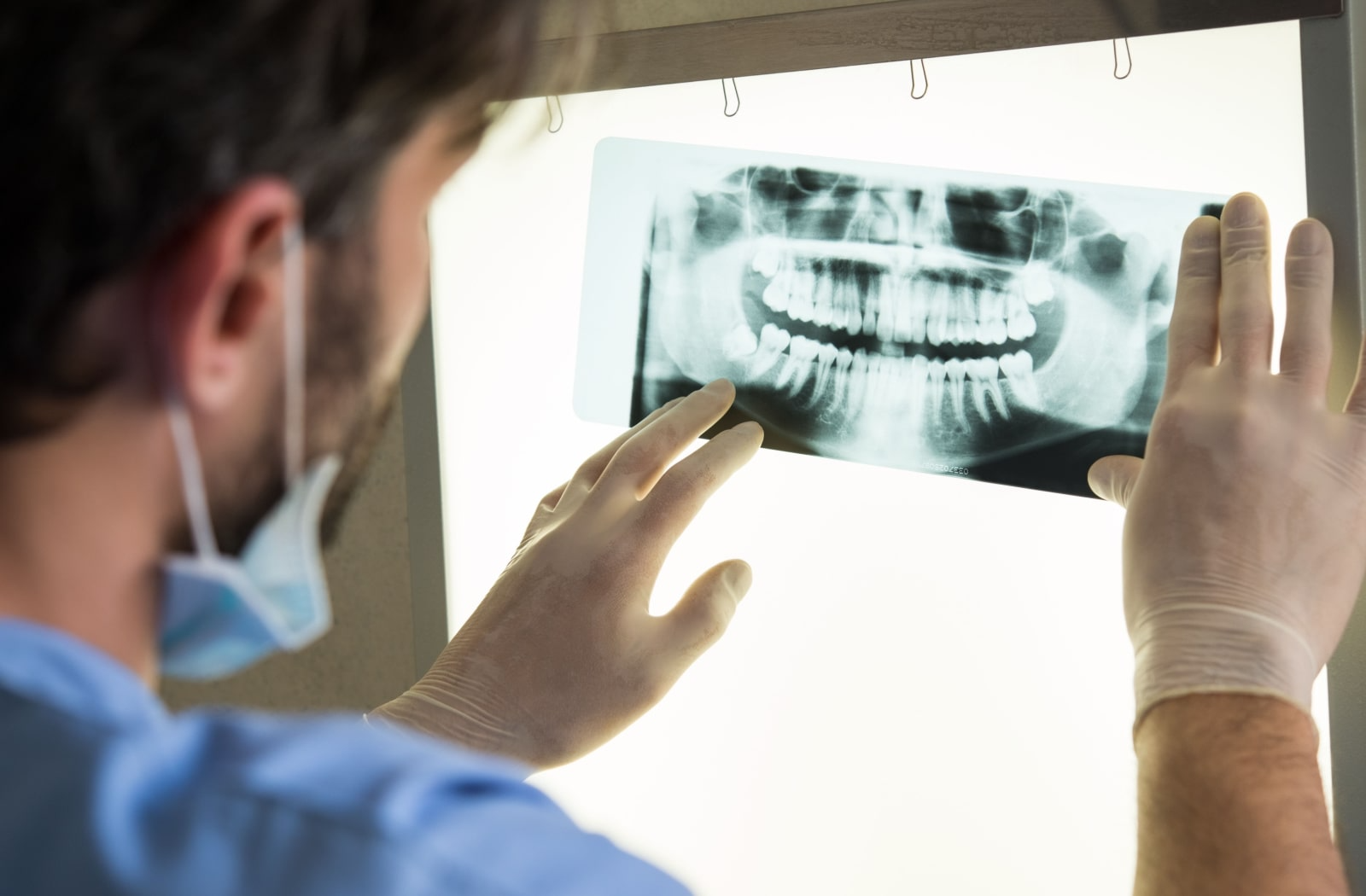 A male dental hygienist looks at a patient's tooth x-ray through the light