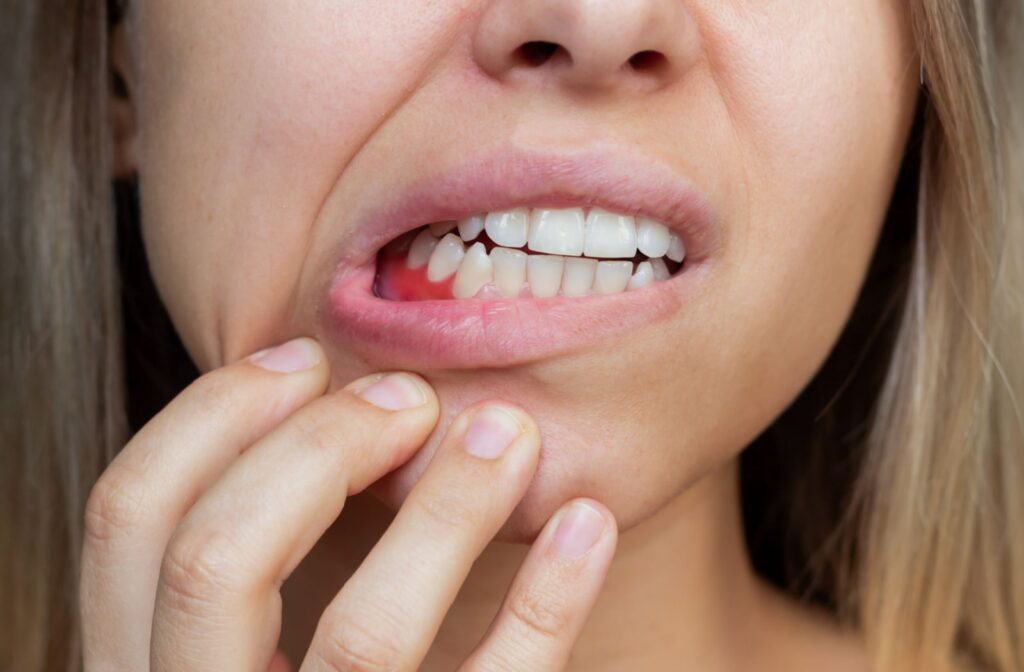 A woman pulls down the right side of her lip to expose her red gums